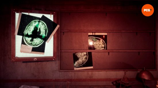 Three pieces of an xray make up a complete image of a brain in the Alone in the Dark xray puzzle.