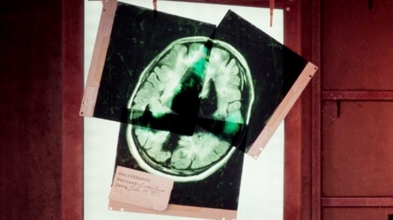 Three pieces of an xray make up a complete image of a brain in the Alone in the Dark xray puzzle.
